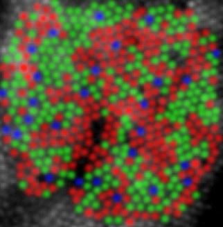 (red), M (green) and S (blue) cones: Remarkably, both subjects have normal color vision!
