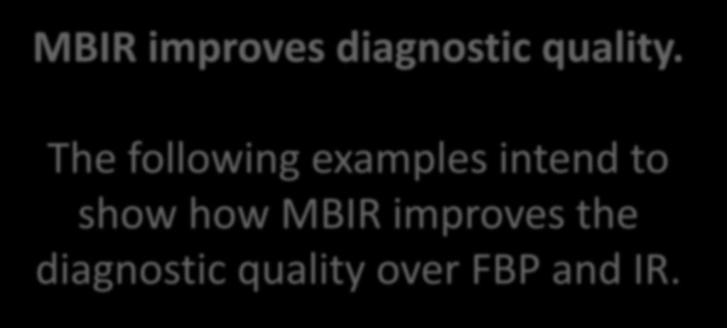 MBIR improves diagnostic quality.