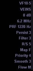 Adjustments PRF - should be set to 977 Hz Dynamic