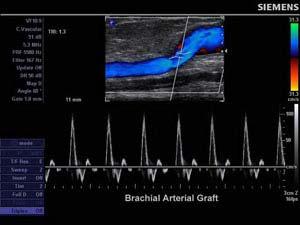 Arterial & Cerebrovascular Exam Quick Set Next, Color Doppler