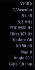 should be set to 3906 Hz Filter - 167 Hz Dynamic Range (DR) - decrease