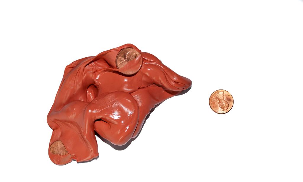 PUTTY Theraputty and Pennies Activity When a child plays with theraputty in their hands, they are strengthening all aspects of the hand.