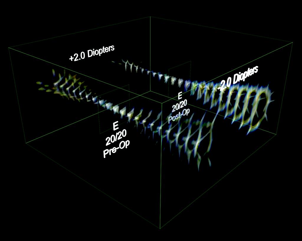 Figure 3. <<The Volumetric Point Spread Function (VPSF) is generated by calculating the PSF at many points through focus, and arranging them to simulate a focused cone of light.