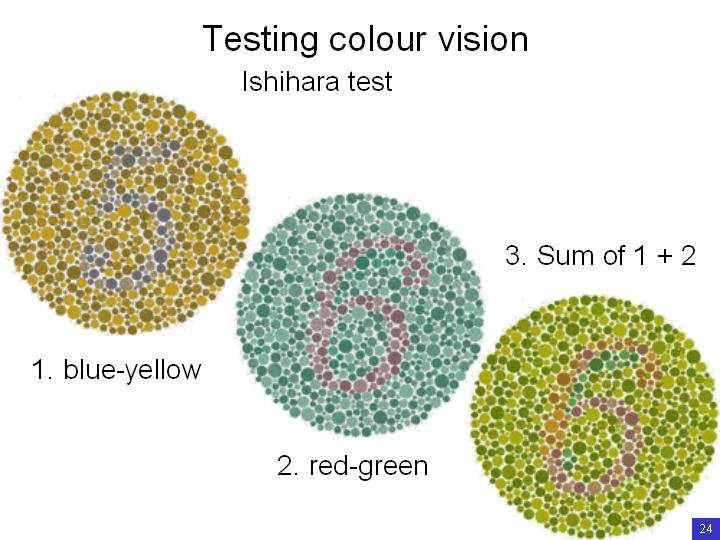 Slide 27 The Ishihara tests are used to detect colour vision abnormalities.