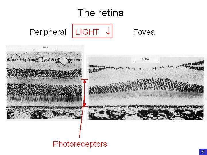 Slide 21 A view of the retina through an ophthalmoscope. This shines a light into the eye and makes an image of the retina.