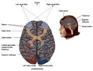 Ultimately all Fibers from the eye end up in area 17, 18, and 19 of the Occipital lobe.