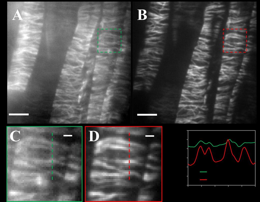 Supplemental Figure 3. Comparison of S/N between epi-fluorescence illumination and VAE illumination. Imaging of Alexa Fluor 647-labeled cortical microtubules under epi-fluorescence (A) or VAEM (B).