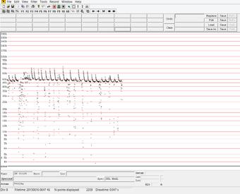 bat calls registered on the Anabat recorder). Soprano pipistrelle calls typically range from 47.3 90.4 khz. Figure A3.