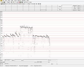 Figure A3.3 Sonogram of a Leisler's bat recorded during the bat survey undertaken on 15 th. Figure A3.