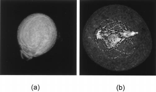880 T. Haishi et al. / Magnetic Resonance Imaging 19 (2001) 875 880 Fig. 7. (a) A cross sectional image of a garden pea acquired with a 3D gradient echo sequence (TR/TE/FA 100 ms/6 ms/90 ).