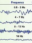 brain wave frequencies