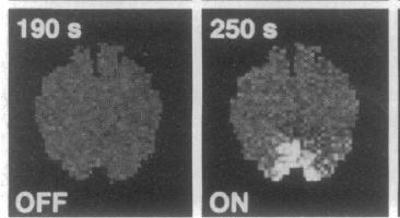 Blood Oxygen Level Dependent (BOLD) effect Ogawa et al., 1990: static BOLD effect in rat brain Kwong et al., Bandettini et al.