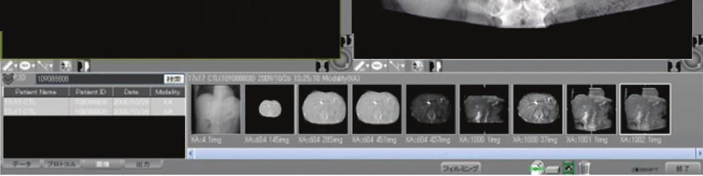 10 Comparison of 12-Inch and 17-Inch Axial Field of View Fluoroscopy and Radiography Using Image Processing Technology by Pattern Recognition *