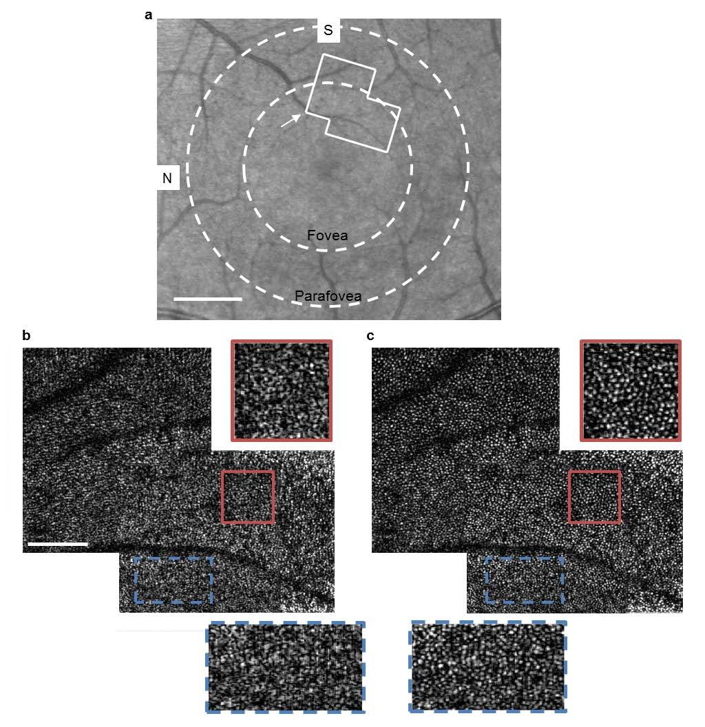 Figure S9 Imaging Subject #2 in the fovea. Cone photoreceptors in the foveal region of the retina from Subject #2. a. SLO image with the location of the photoreceptor mosaic outlined. b.