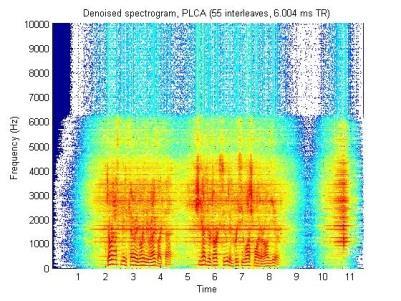 PLCA Results PLCA removes noise