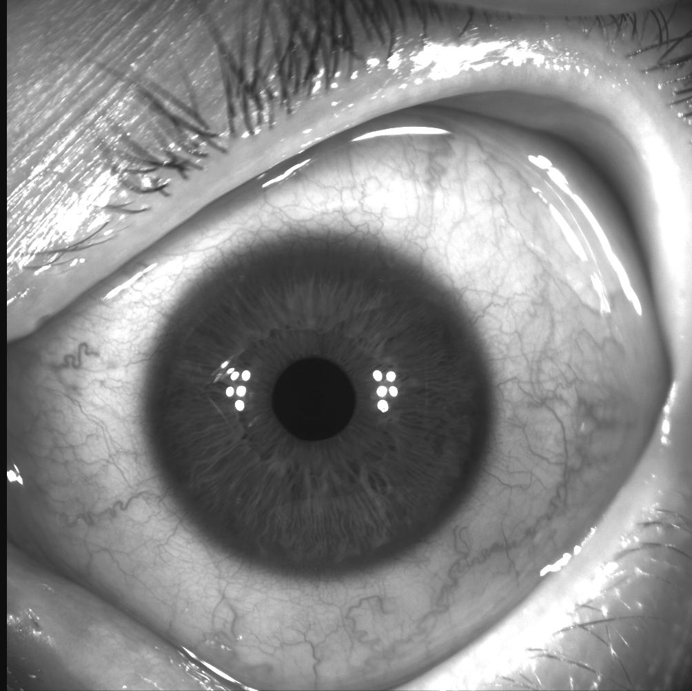 intensity profile on eye from LV LADARWave Image