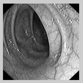 can significanly lower he compuaional complexiy. The number of Osu ieraions incurred by he proposed and baseline mehod for he sample endoscopic images are presened in Fig. 9. B.