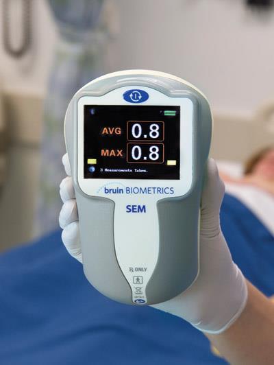 53 Handheld, portable electron scanners detect early-stage pressure ulcers at the point of care before skin discoloration or breakdown With