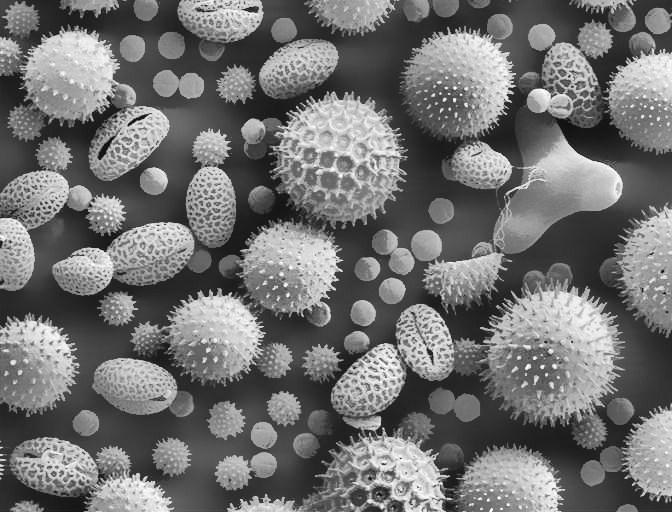 (a) (b) (c) (d) Figure 4.4 (a) Original image Pollen Grain of a low-contrast microscopic image of pollen grains.
