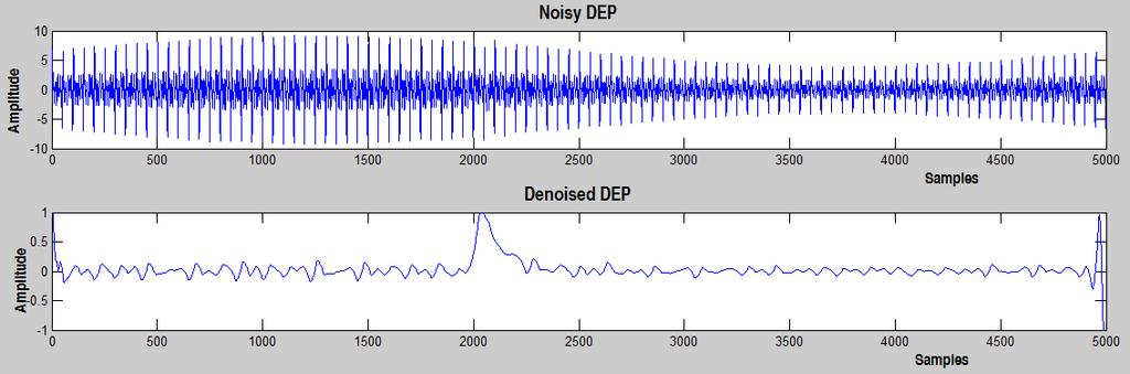 International Journal of Industrial Electronics and Electrical Engineering, ISSN: 47-698 For the DEP and DOP signals corrupted by both white noise and DSI, using the level dependent method, the