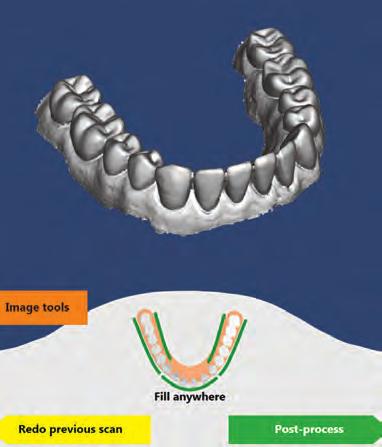 One scan captures it all Unique to orthodontic impression systems, Ormco s AFI technology captures data in real time (vs.