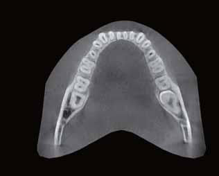 The arch-shaped volume eliminates this possibility and shows the hidden dentition area.