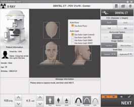 [TMJ] Simultaneous Analysis for both TMJ TMJ Navigator TMJ Segmentation Instant automatic cross-sectional images *Airway
