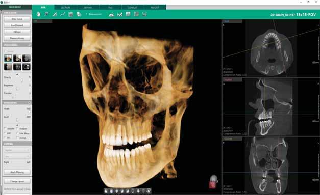 MIP Mode Soft-Tissue Mode Virtual Consultation Tool Over 200 Consultation Videos Creation of Personalized Consultation Materials Implant