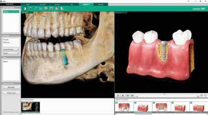 views 2-CLICK AIRWAY ANALYSIS With two clicks,