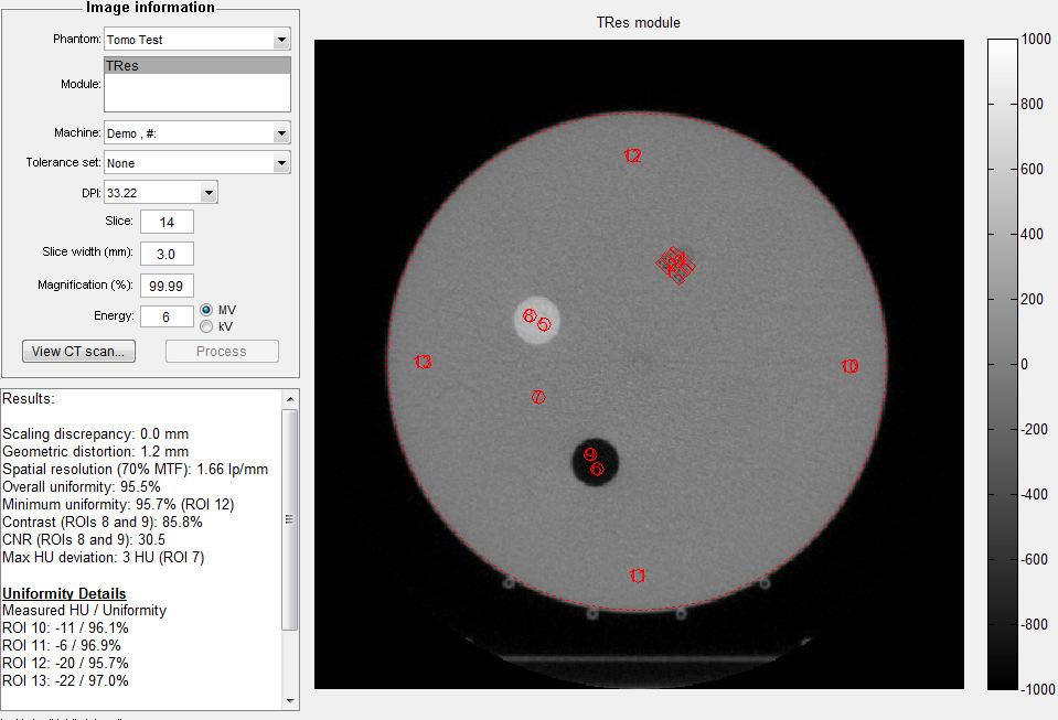 DOSELAB TOMOTHERAPY TG-148 QA QUICK GUIDE Rev. 1.0 10. V.I.B.2 - IMAGE QUALITY 1. Obtain the MVCT images as described in TG-148 2. From DoseLab s main interface, choose CT / CBCT 3.