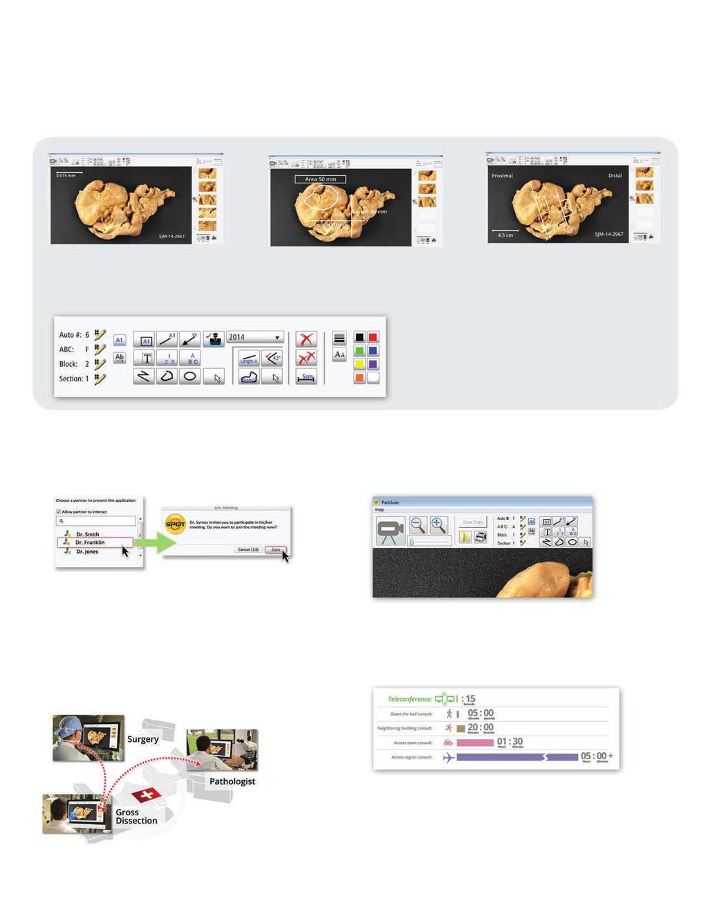 PathStation TM Optimized Interface Measurement and Annotate PathSuite provides a full suite of annotation and measurement tools for detailing your images without transferring images between programs