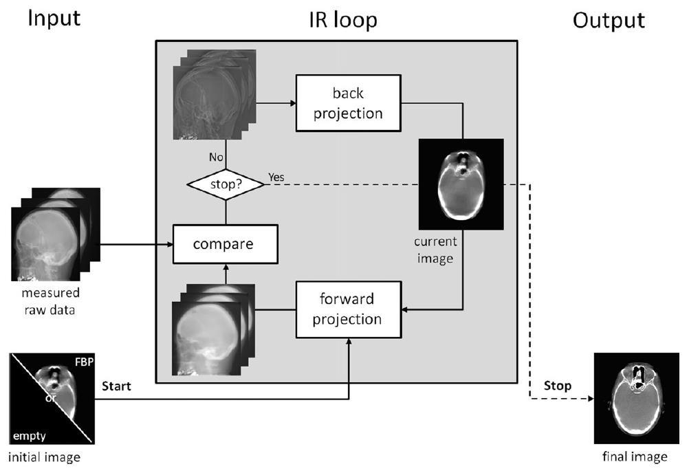 HOW DOES ITERATIVE RECONSTRUCTION (IR) WORK?