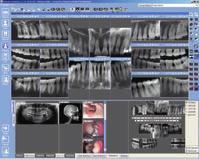 processing intraoral images, offering a wide range of tools for image
