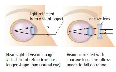 Near-sightedness Near-sighted people can see nearby objects clearly but cannot bring distant objects into focus (Ms. Saville). These people usually have to wear glasses/contact lenses all day long.