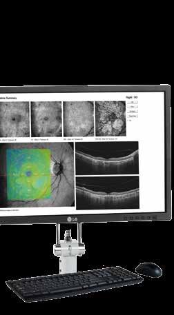 AVANTI XR Comprehensive wide-field OCT imaging Powerful 3D imaging Motion correction scanning, combined