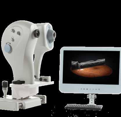 ifusion Complete SD-OCT & retinal imaging solution Integrated OCT & fundus imaging ifusion combines the best of OCT and fundus imaging in one compact instrument.