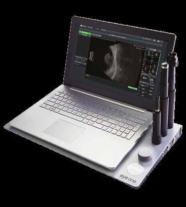 EYE ONE Diagnostic ultrasound on the move.
