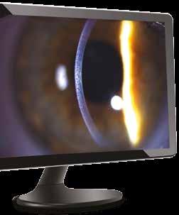 BQ 900 SLIT LAMP Built for a once-in-alifetime purchase The instrument of choice The BQ 900 LED slit lamp combines precision