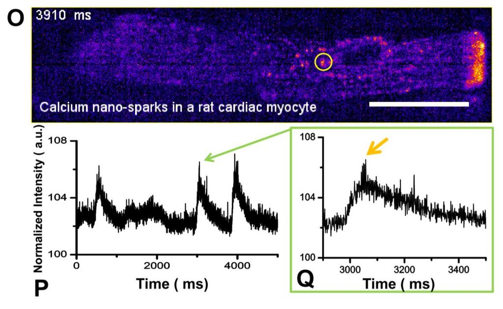 Supplementary information, Figure S1O-S1Q Ultrafast calcium nanosparks measured in a rat cardiac myocyte.
