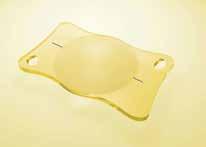 MFM 611 BB MFM 611 BB T MFM 611 Material Hydrophobic surface, acrylic with 25% water content, UV filter Optic Size 6.00 mm Optic Design Biconvex Haptic Size 11.