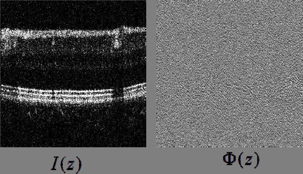 Figure 2. Fourier domain optical coherence tomography: intensity profile (I(z)) and phase profile (Ф(z)).