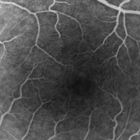 Figure 4 (b) shows the FA image over the same region for comparison. The phase variance OCT image is similar to the FA image blood vessel networks of the retina.