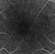 (a) (b) Figure 4. Human retinal vasculature images. Image size is 3x3mm 2. (a) Phase variance OCT retinal summation image. The imaging acquisition time is 3.