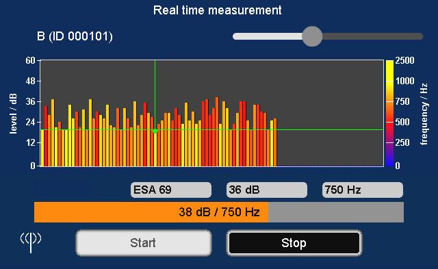 Real-time measurement View measurement results The course of the real-time measurement is shown on the Correlator's screen with a running bar diagram.
