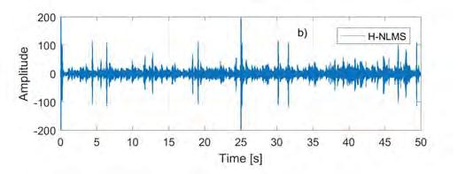 Performance comparison of the H-SKF and the H-NLMS algorithm for -6 db speech volume level; a) MIS; b) ASG. Fig. 10.