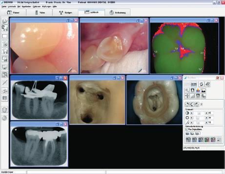 iX combines the image quality of Dürr Dental IFC optics with the convenience of mobility.