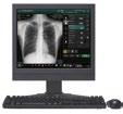 information quickly and accurately. The image display area on the display monitor is larger, and enables easy checking of diagnostic images.