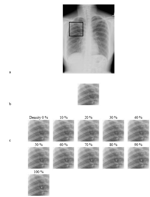 Fig. 4: a) original x-ray chest image (1536x2048 pixels) from JSRT [Shi 00] b) reference image: background,