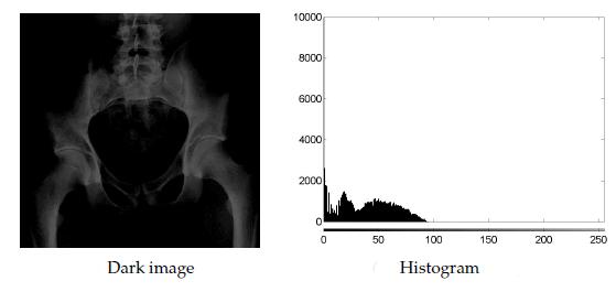 Histogram Processing in Spatial Domain It is an important approach for image enhancement and it is basis for numerous techniques.