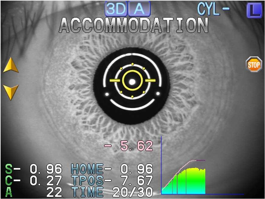 1-2. Accommodation Measurement While the fixation target approaches, it measures refraction